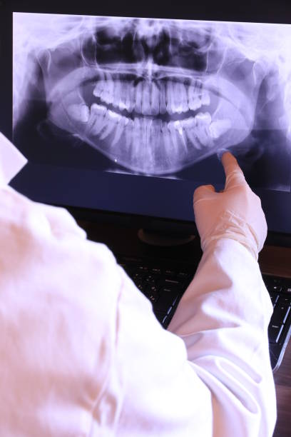 Best Emergency Tooth Extraction in Unionville, NC
