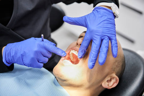 Best Emergency Tooth Extraction in Unionville, NC