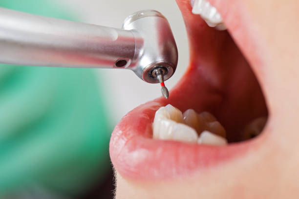 Best Weekend Emergency Dentist in Unionville, NC